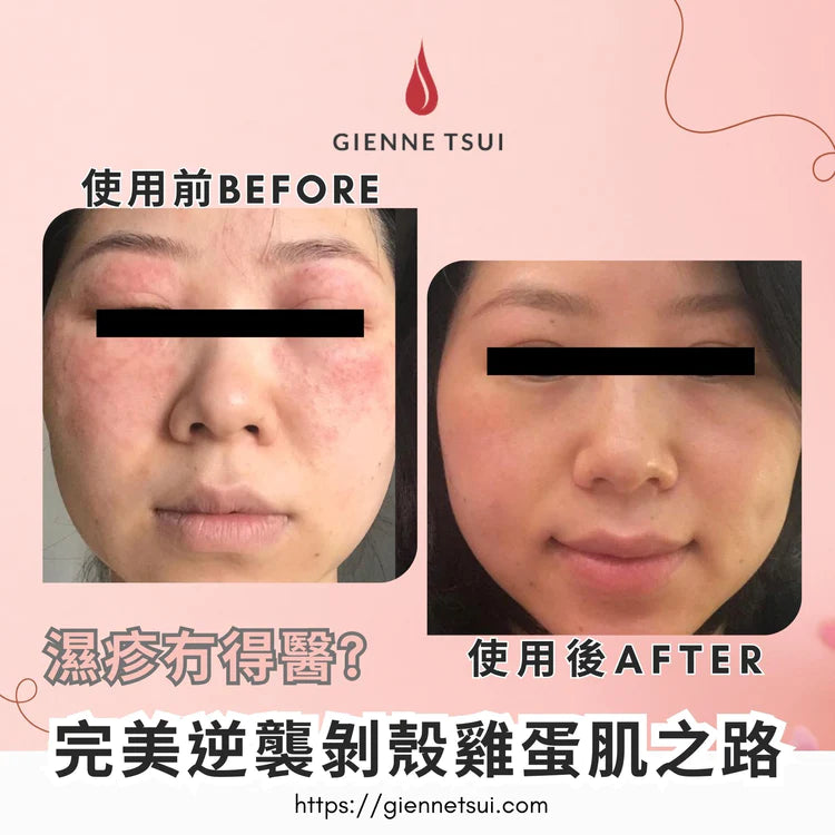 資深美容師𝗔𝗿𝗶𝗲𝗹加入𝗚𝗶𝗲𝗻𝗻𝗲 𝗦𝗸𝗶𝗻𝗰𝗮𝗿𝗲 的分享